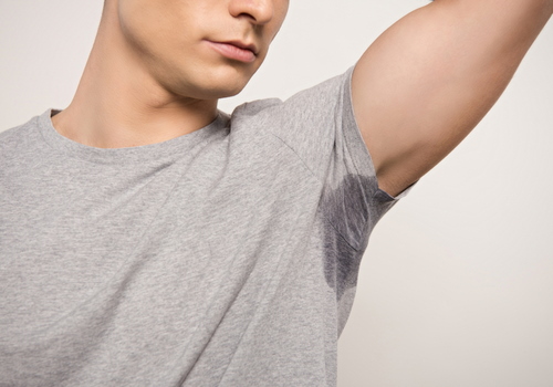 Hyperhidrosis Treatment (Excessive Sweating) | Cosmedics Skin Clinics